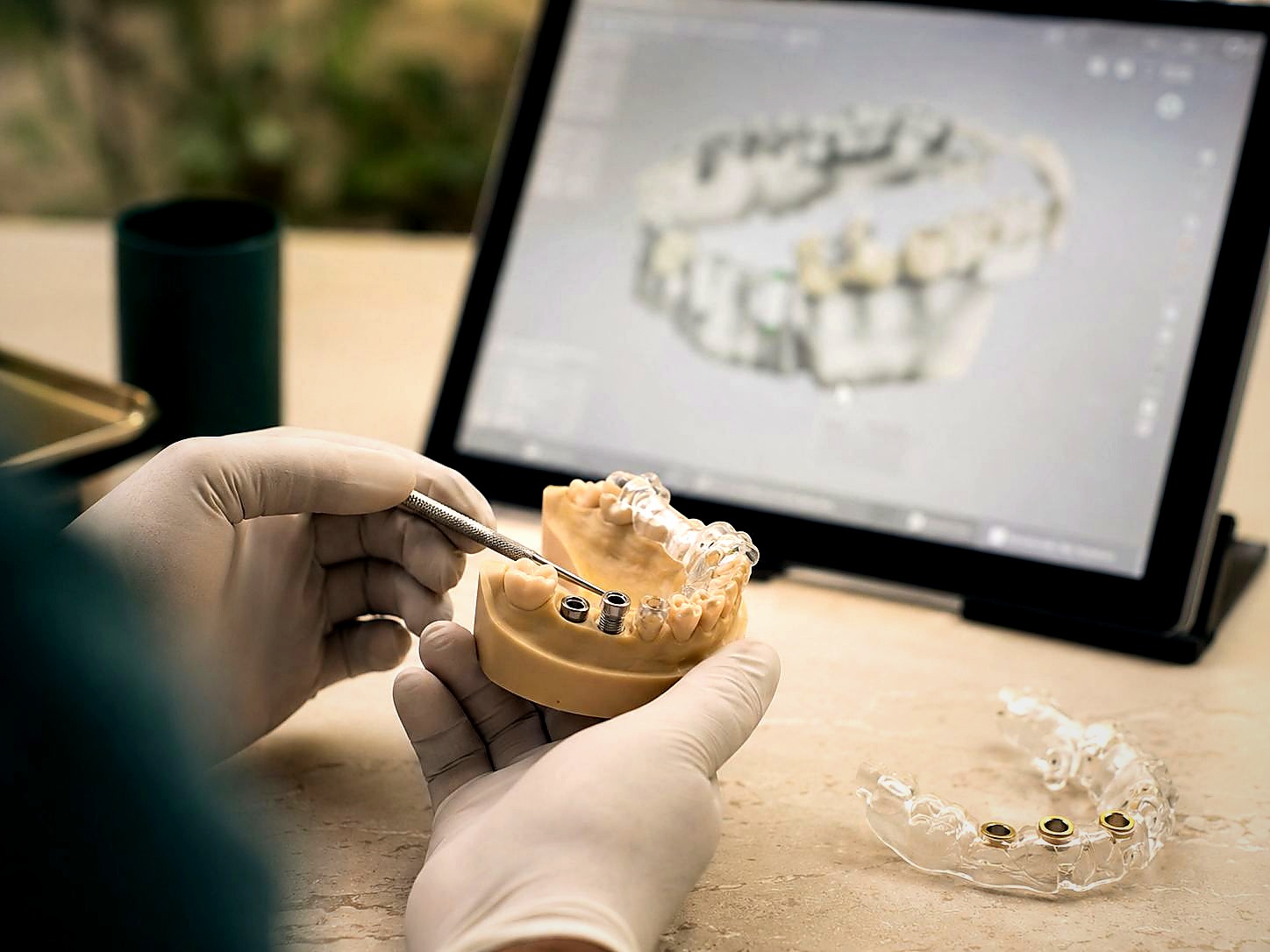 Precision implant planning detail